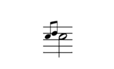 Music enthusiasts often correlate the "turn" symbol in notation with frequent online searches of "s music note" and "s note music."
